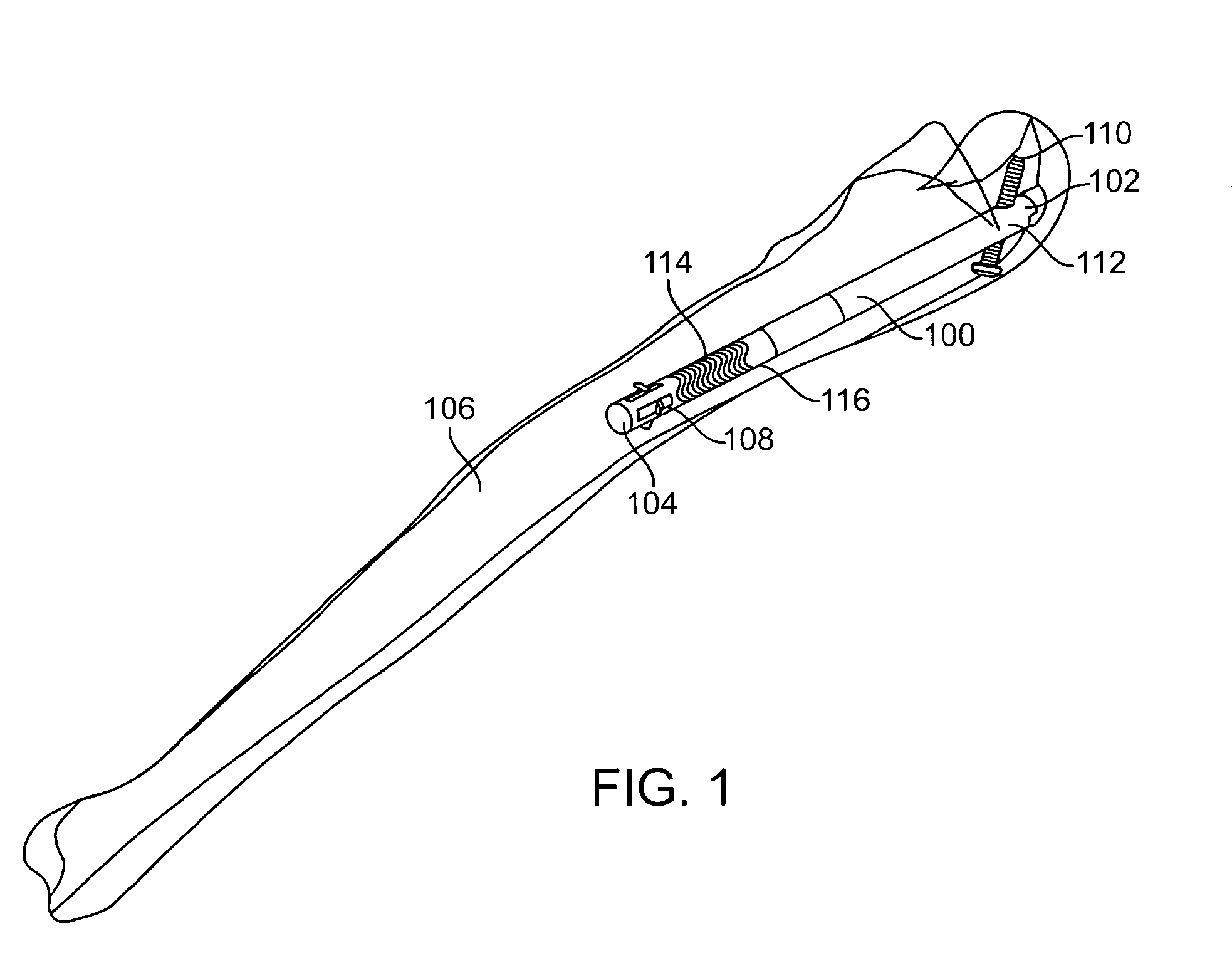 Bone fixation device, tools and methods