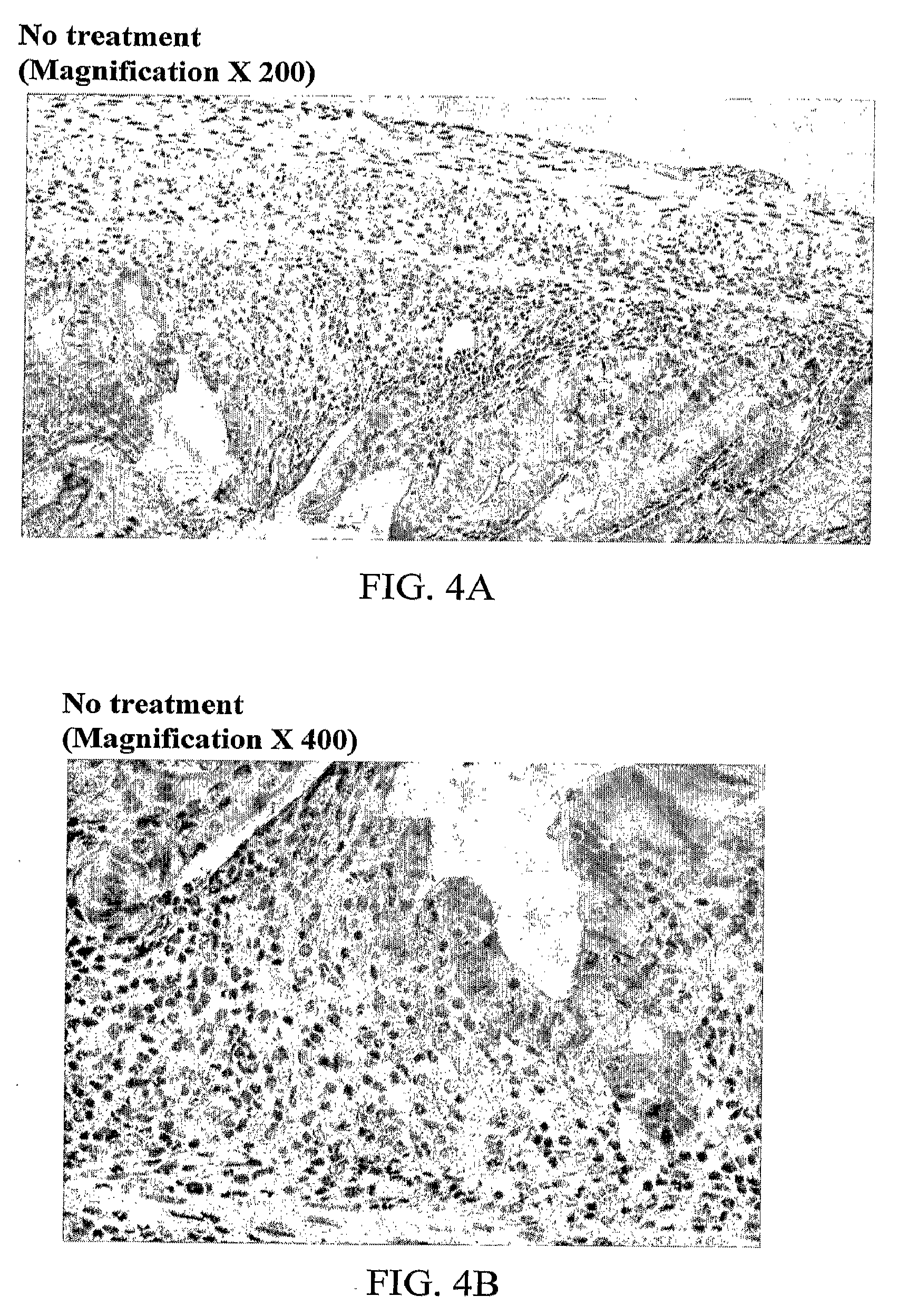 Antisense oligonucleotides against acetylcholinesterase for treating inflammatory diseases