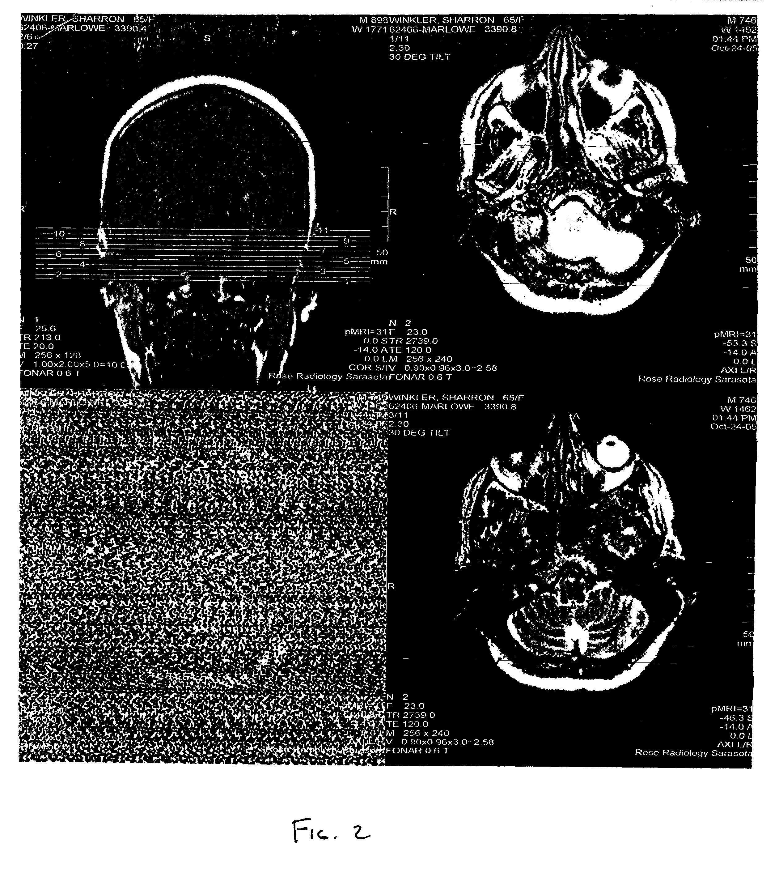 Method of detecting and compensating for faults in an MRI process