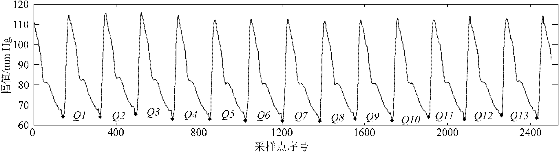 Method for identifying dicrotic notch point in arterial tension signal