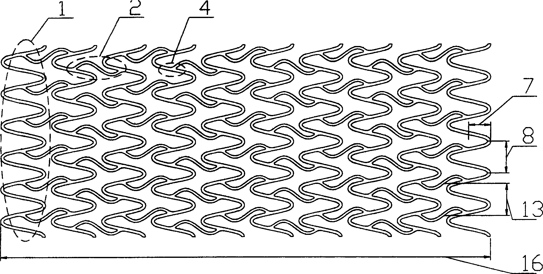 Sine-wave tubular medical interventional stent