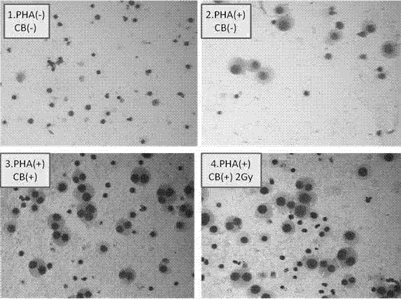 Method for detecting lymphocyte transformation by utilizing medicament cytochalasins B