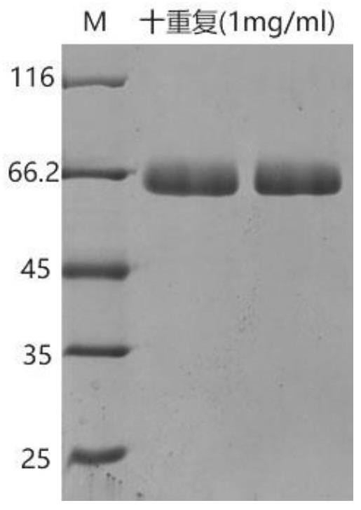 Recombinant III-type humanized collagen, nucleic acid, carrier and implant