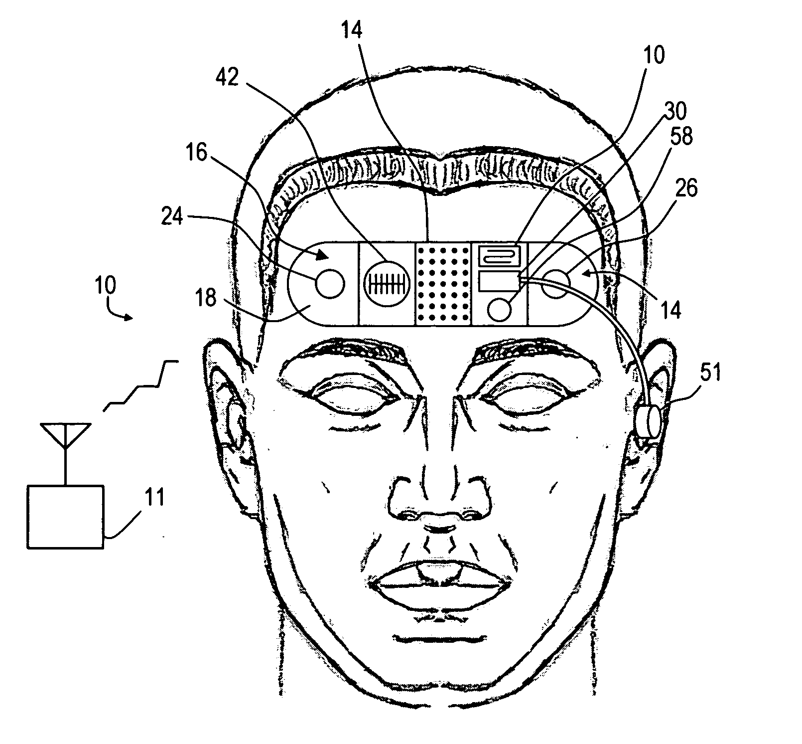 Device and method for transmitting physiologic data