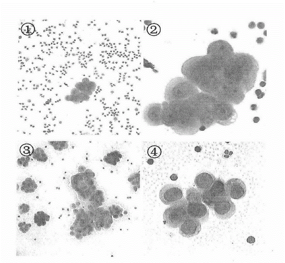 Immunomagnetic head negative enrichment method and application thereof