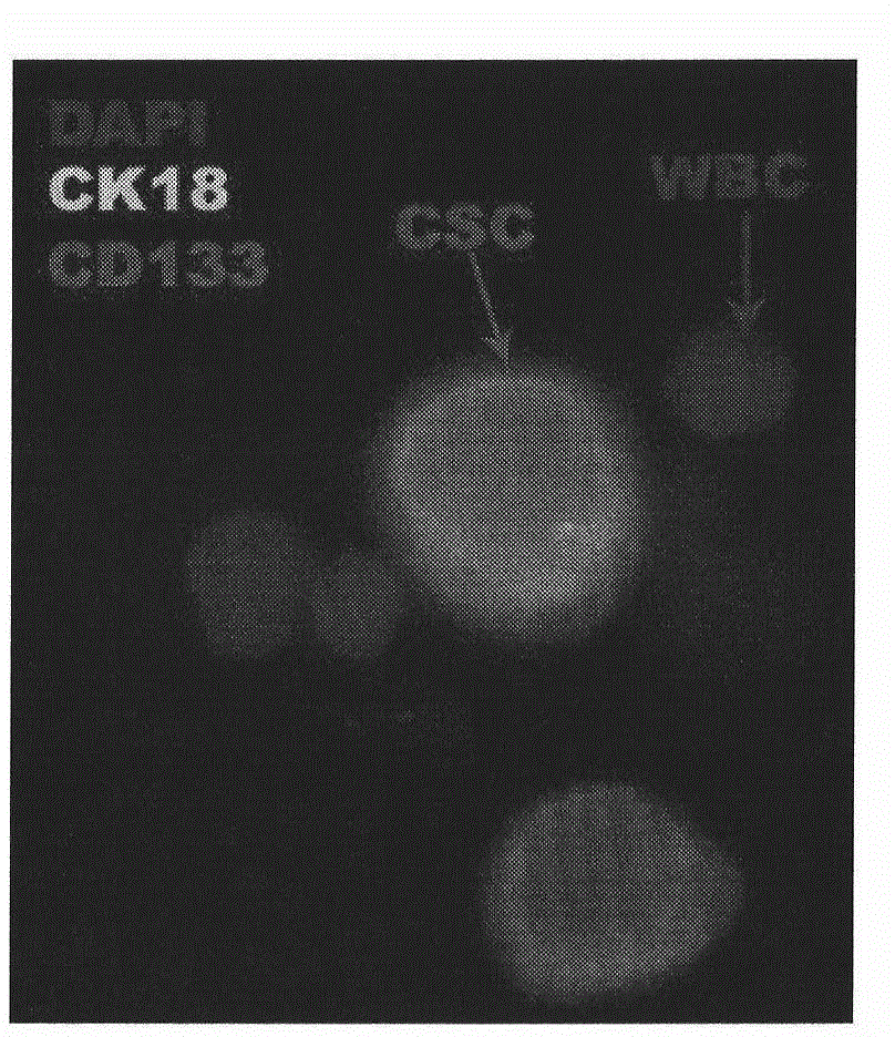 Immunomagnetic head negative enrichment method and application thereof