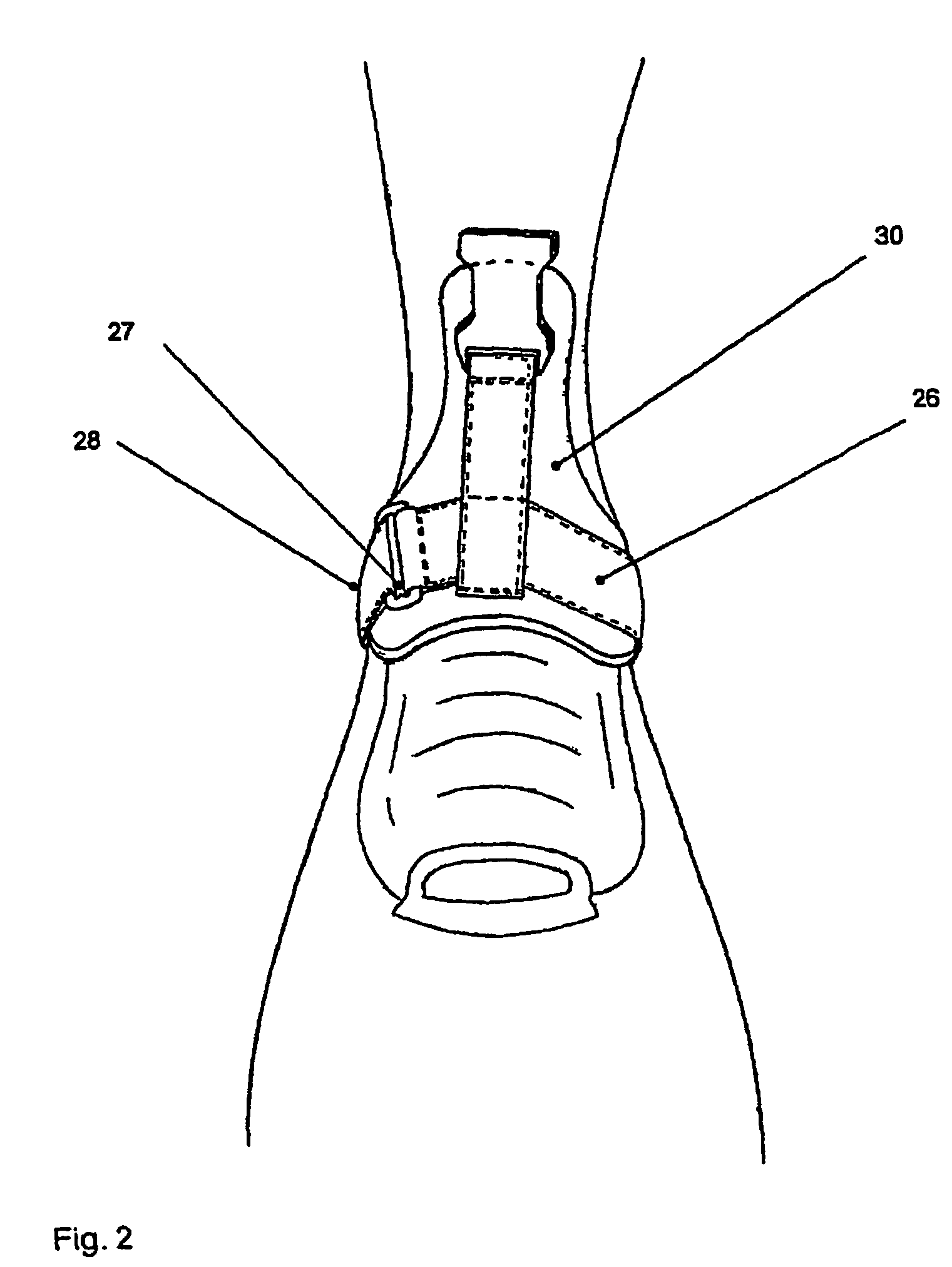 Diving apparatus