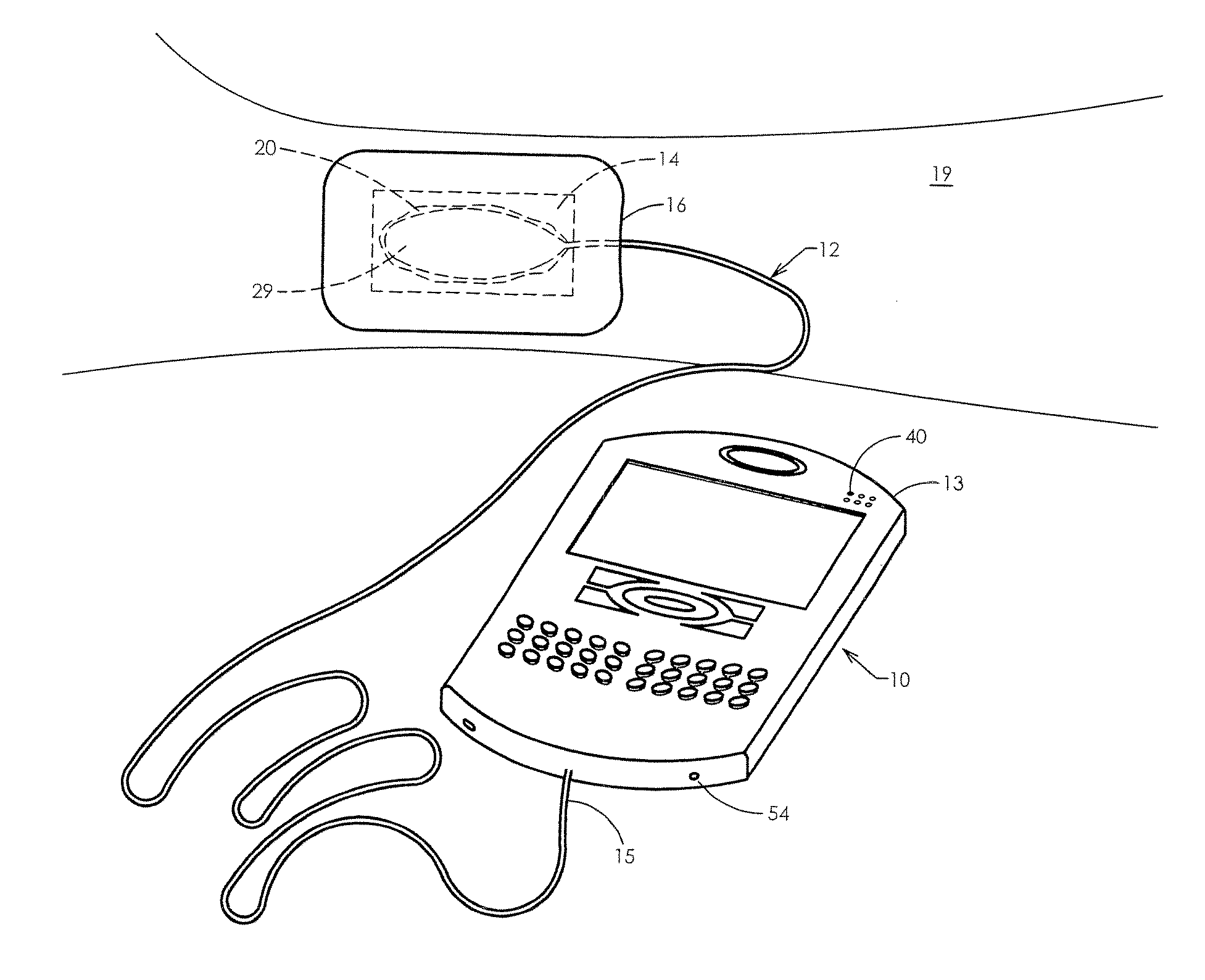 Apparatus and Methods for Controlling Tissue Oxygenation for Wound Healing and Promoting Tissue Viability