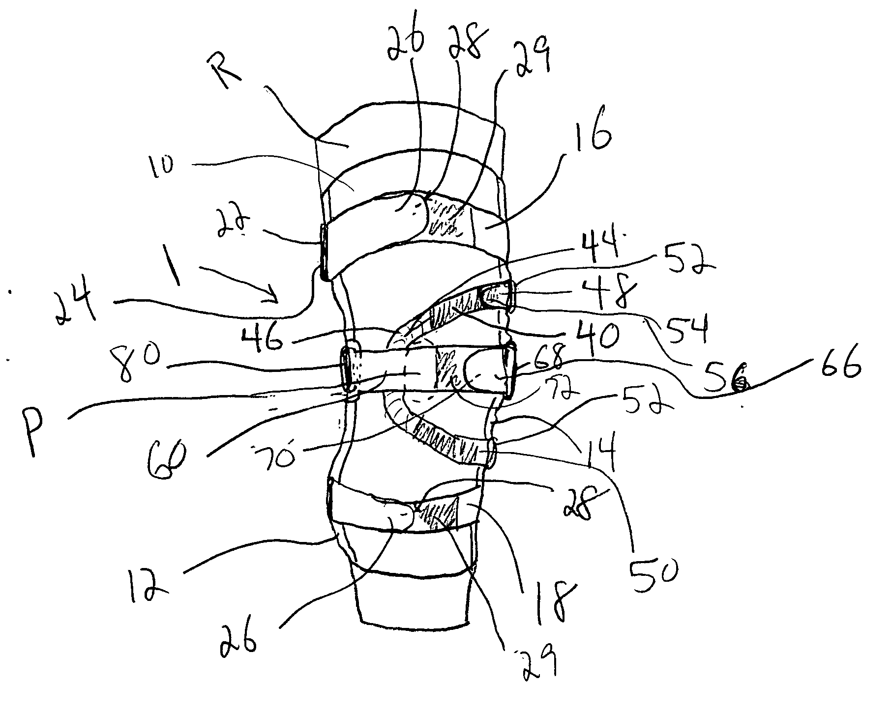 Knee orthosis and orthotic method