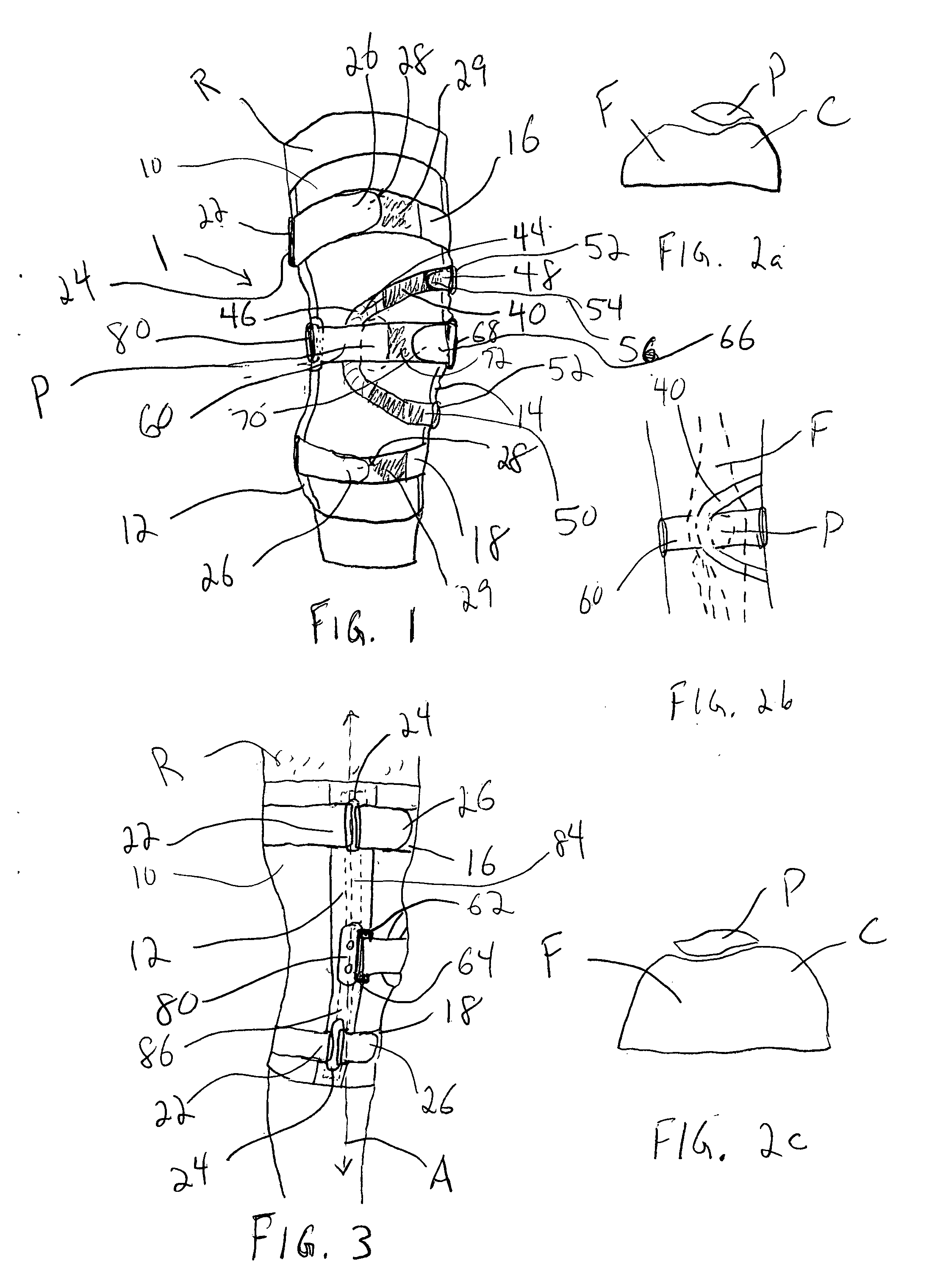 Knee orthosis and orthotic method