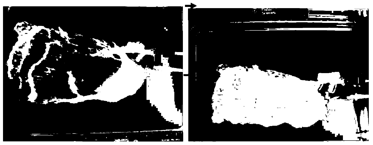 Skeletal muscle whole organ acellular matrix, its preparation method and its derived medical products