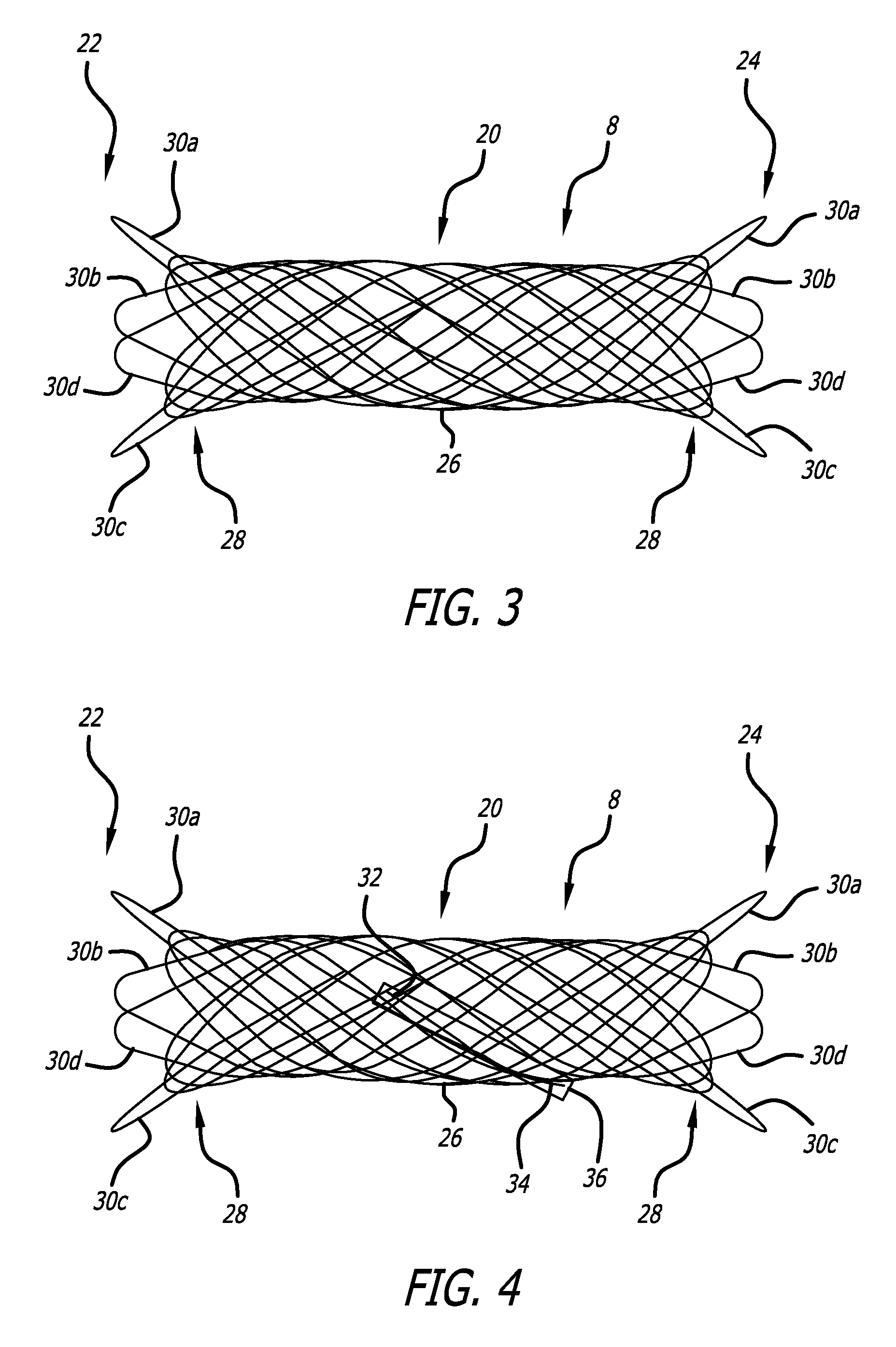 Radiopaque super-elastic intravascular stent