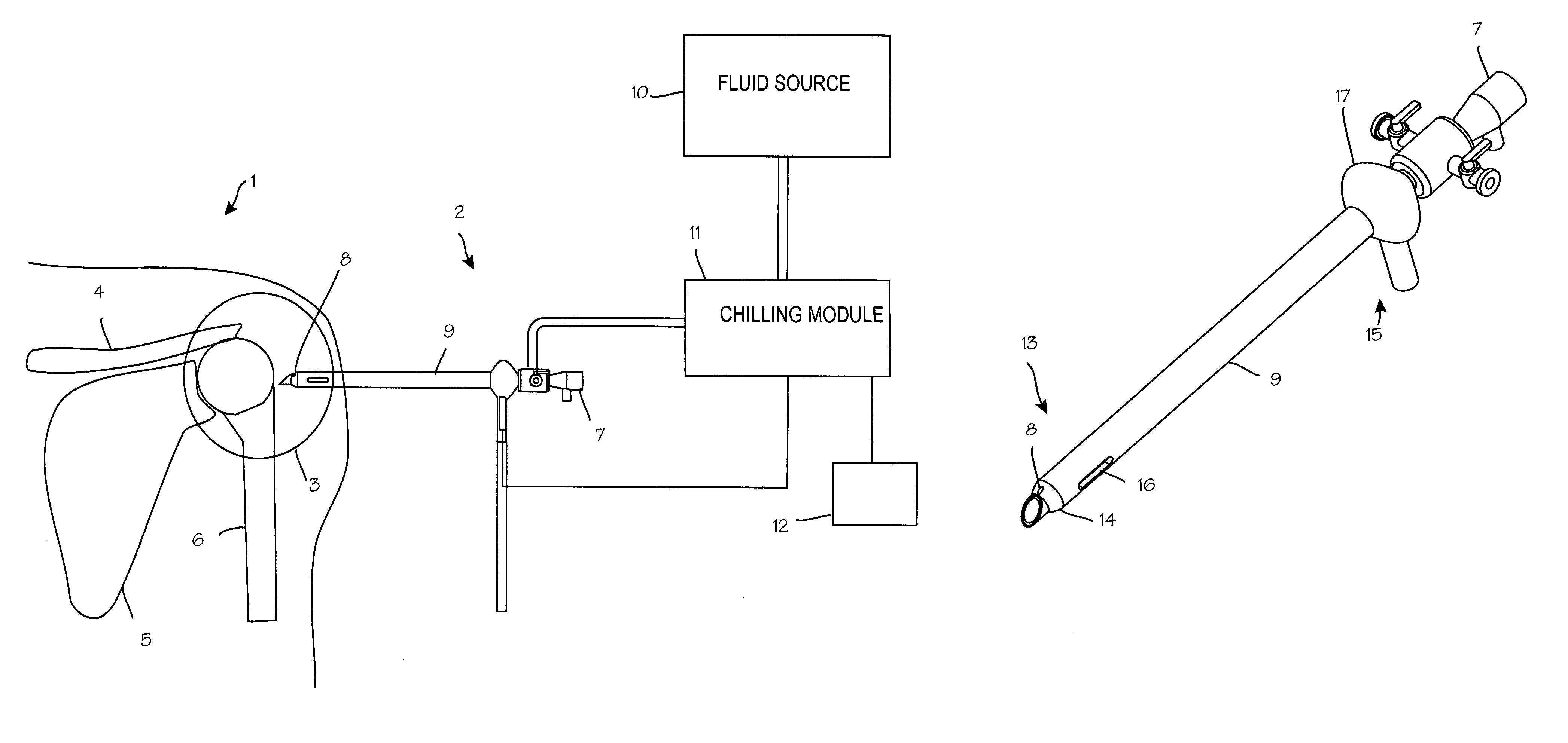 Arthroscopic surgical temperature control system