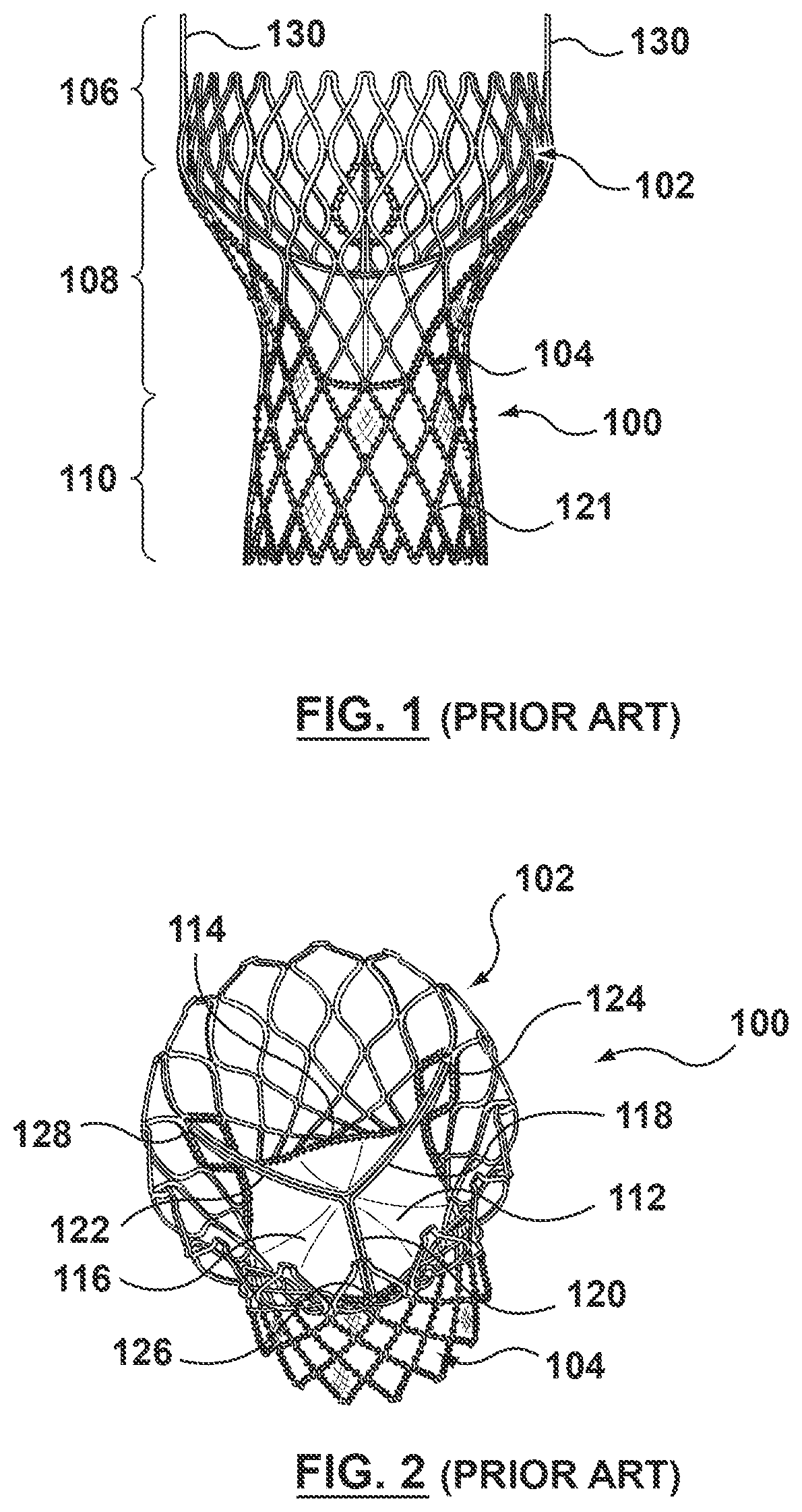 Two-piece valve prosthesis with anchor stent and valve component