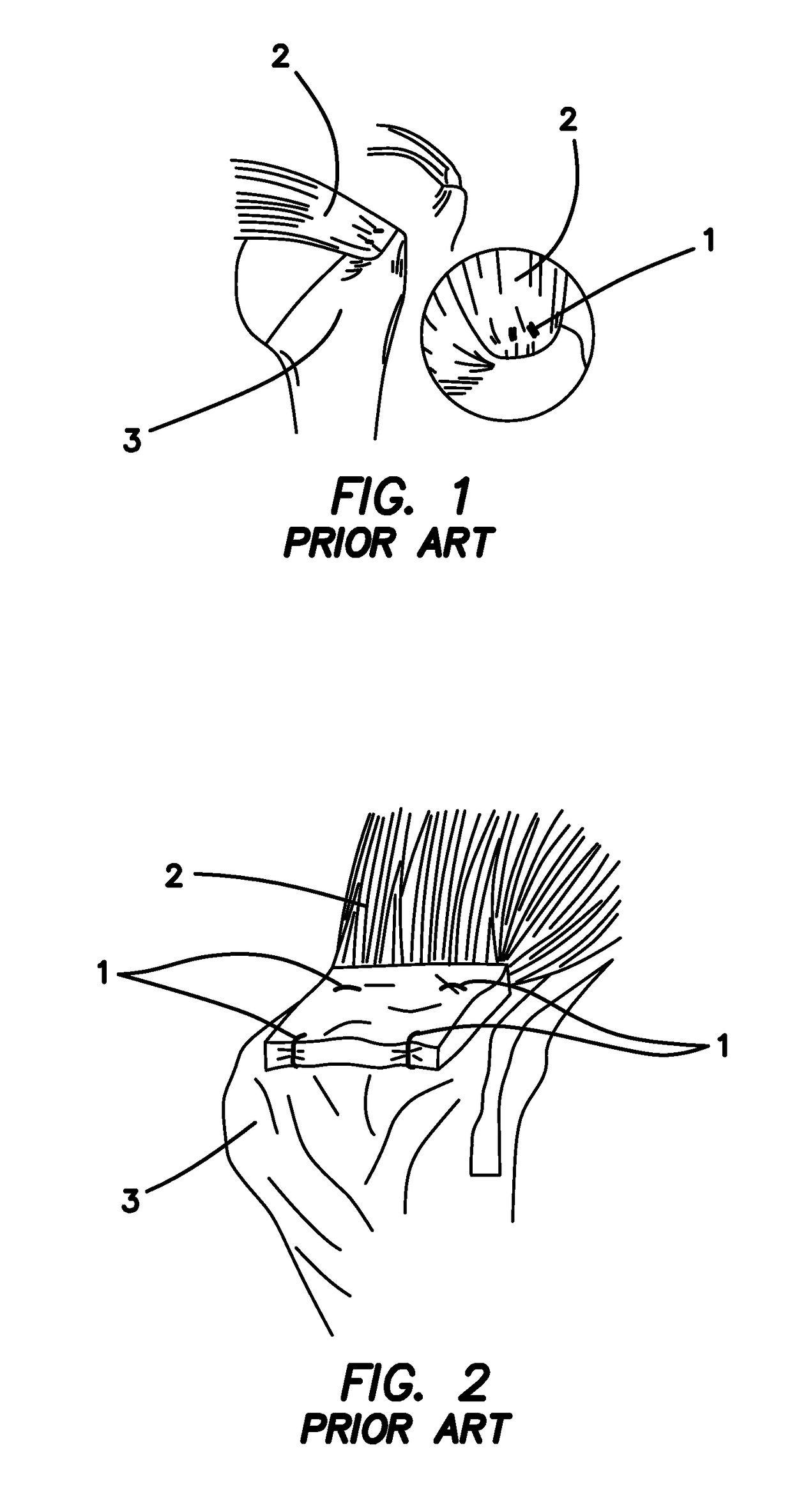 Systems and methods for repairing soft tissues using nanofiber material