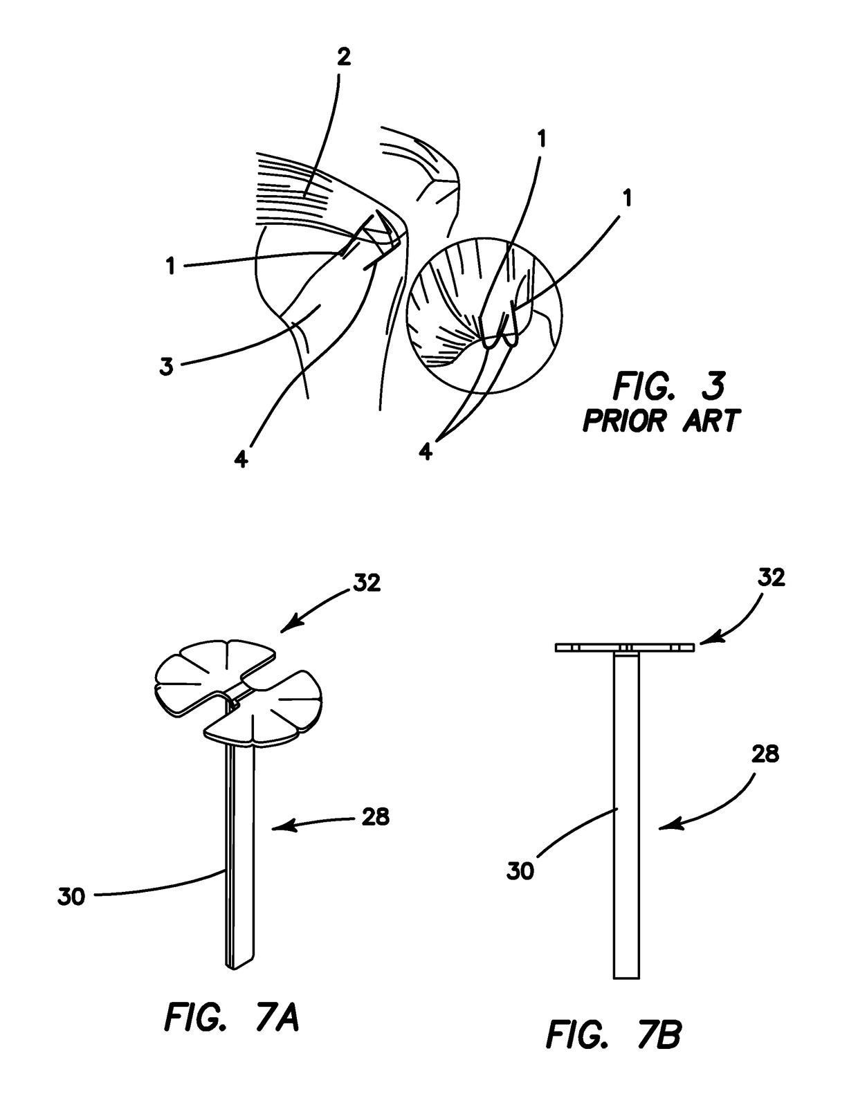 Systems and methods for repairing soft tissues using nanofiber material