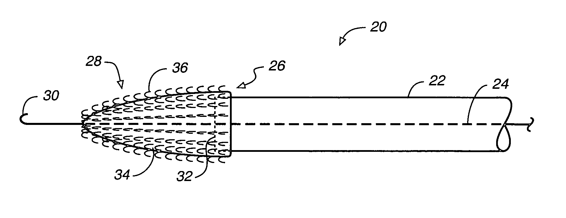 System for closing an opening in a body cavity