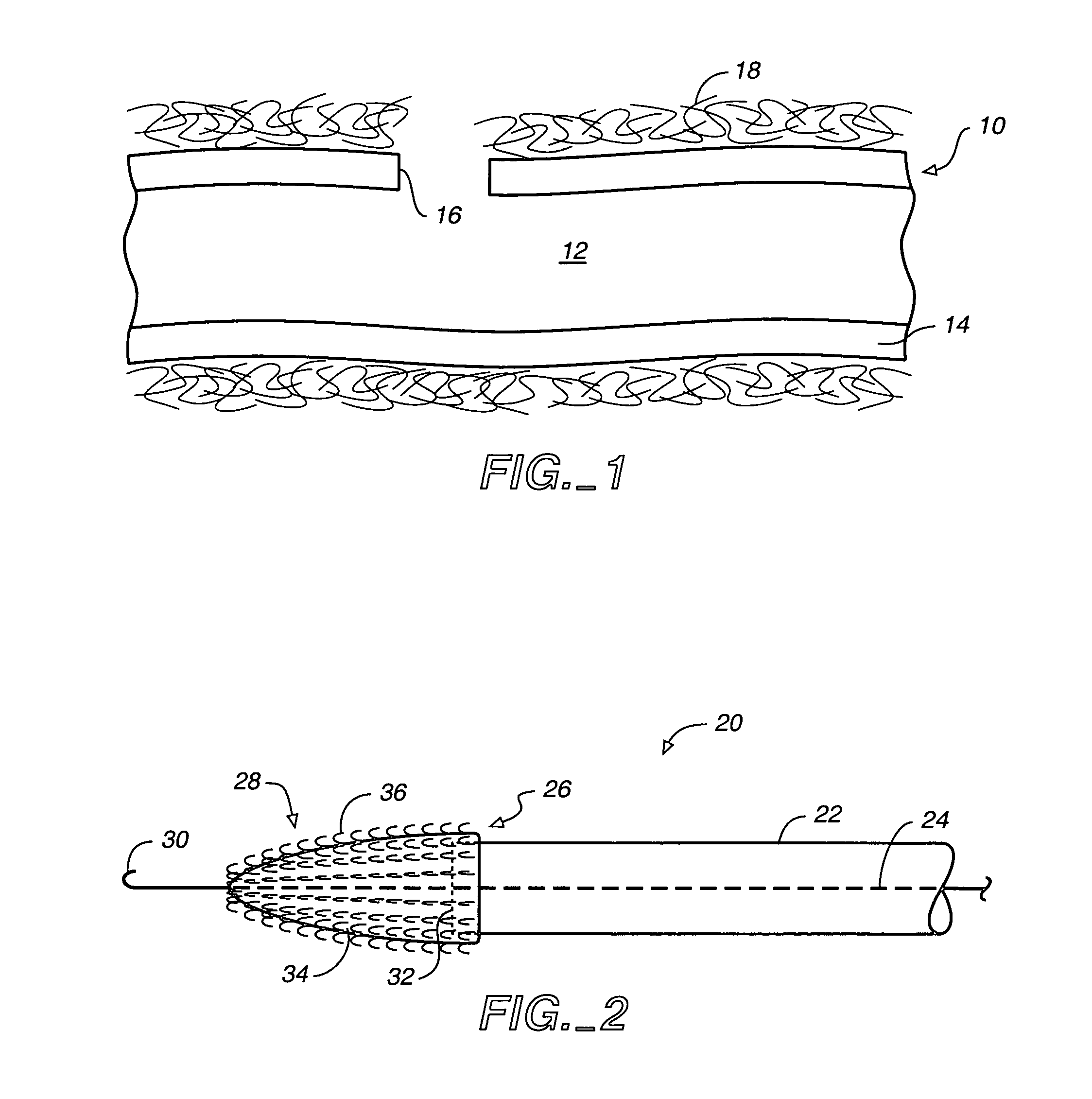 System for closing an opening in a body cavity