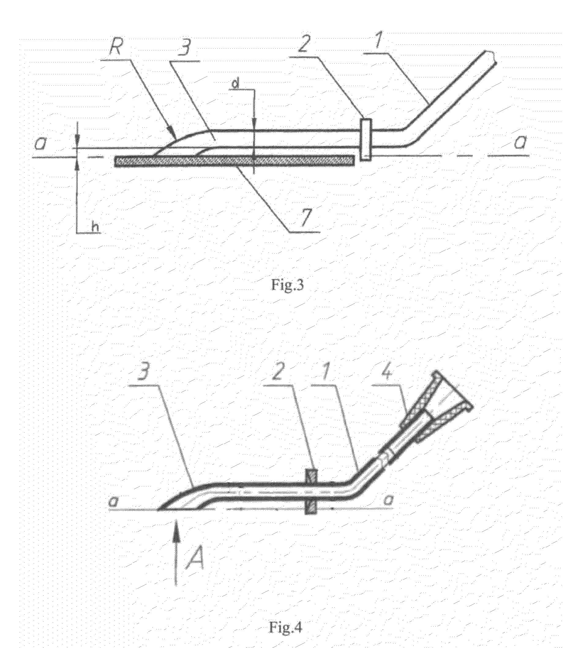 Method of Refraction Surgery of the Eye and a Tool for Implanting Intraocular Refractive Lens