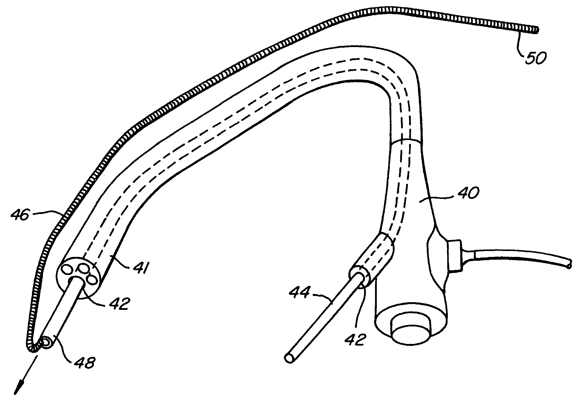 Lung access device