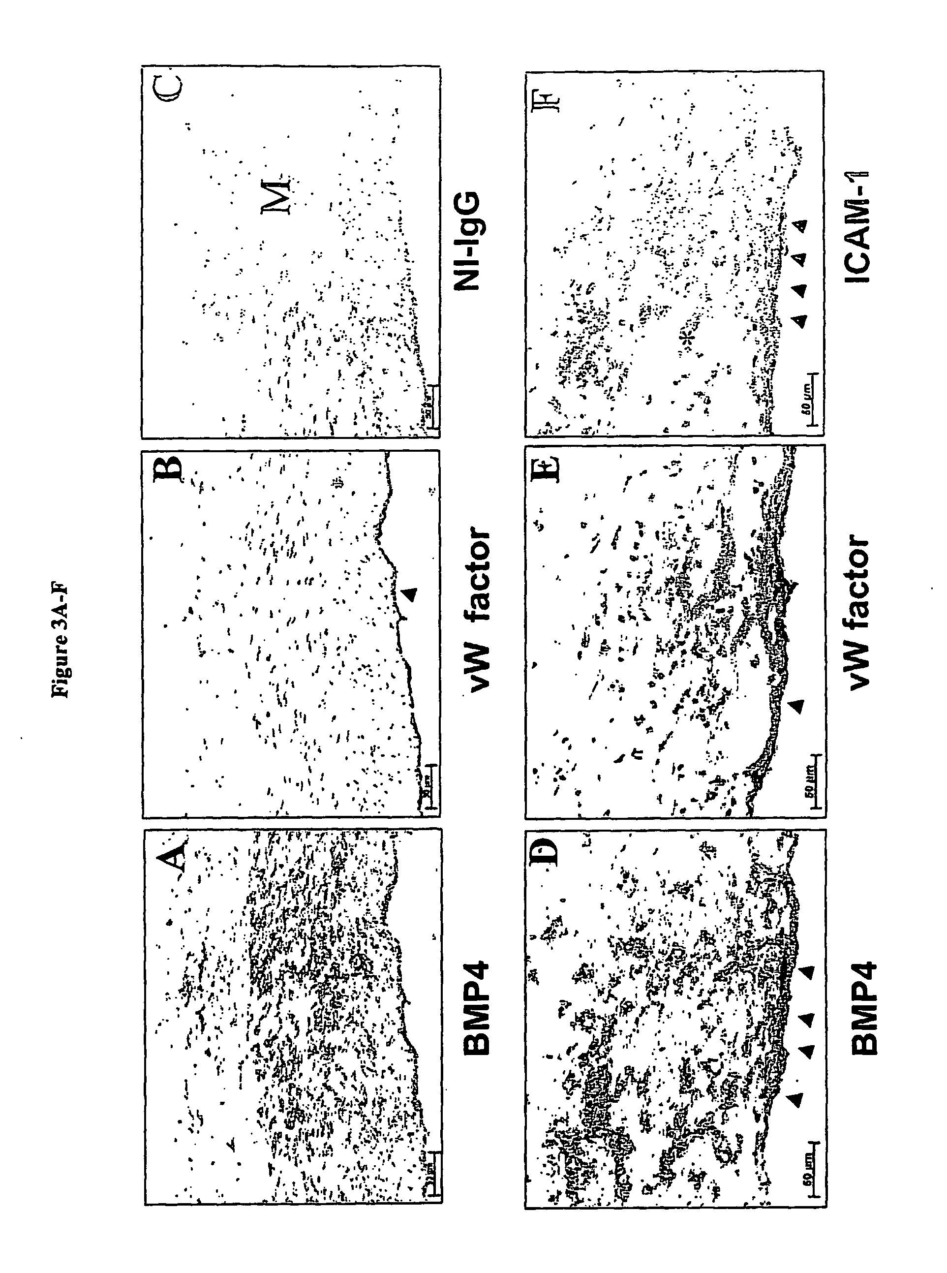 Anti-inflammatory agents and methods of their use