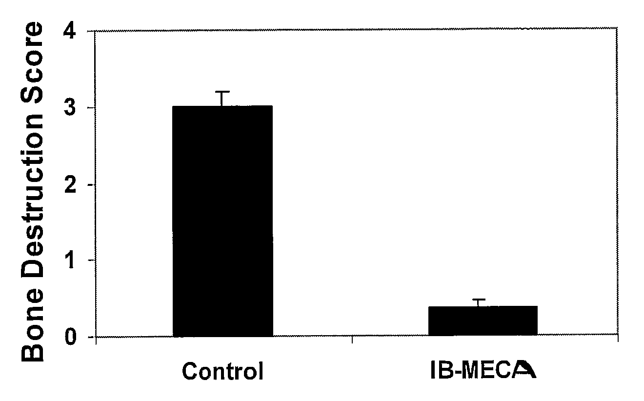 Therapeutic Treatment of Accelerated Bone Resorption