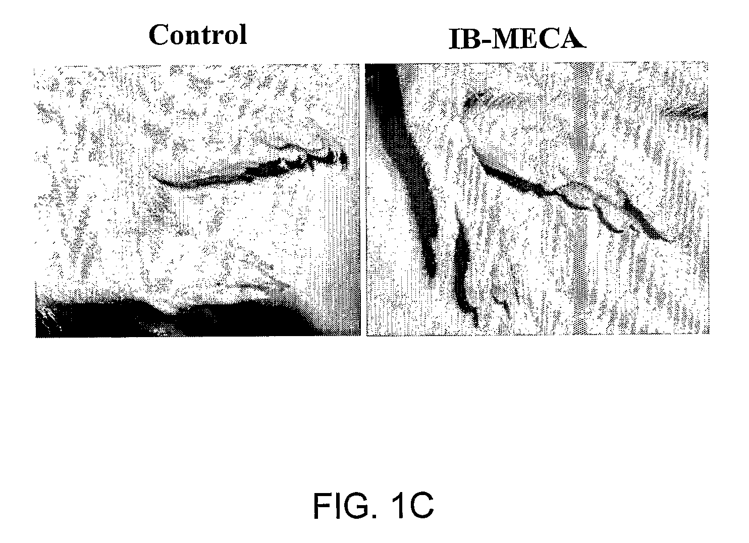 Therapeutic Treatment of Accelerated Bone Resorption