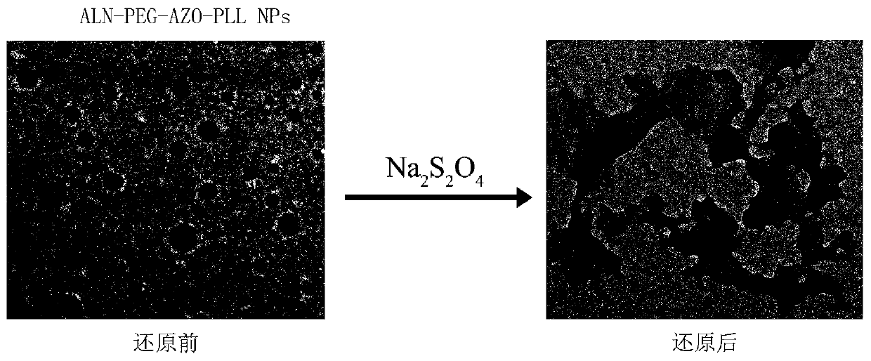 Bone-targeting hypoxic response nano-micelle loaded with anti-cancer drug and preparation method thereof