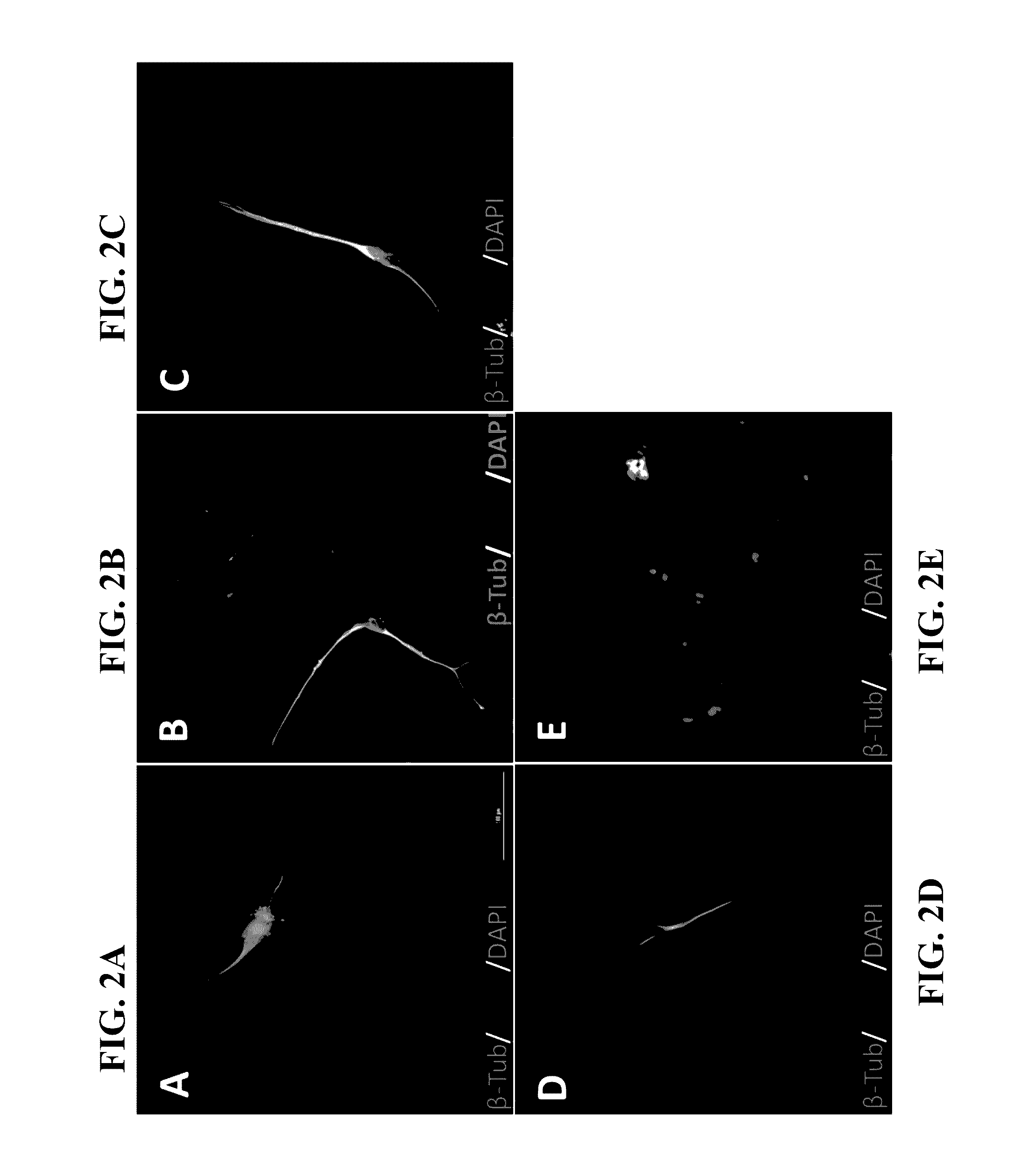 Conversion of non-neuronal cells into neurons