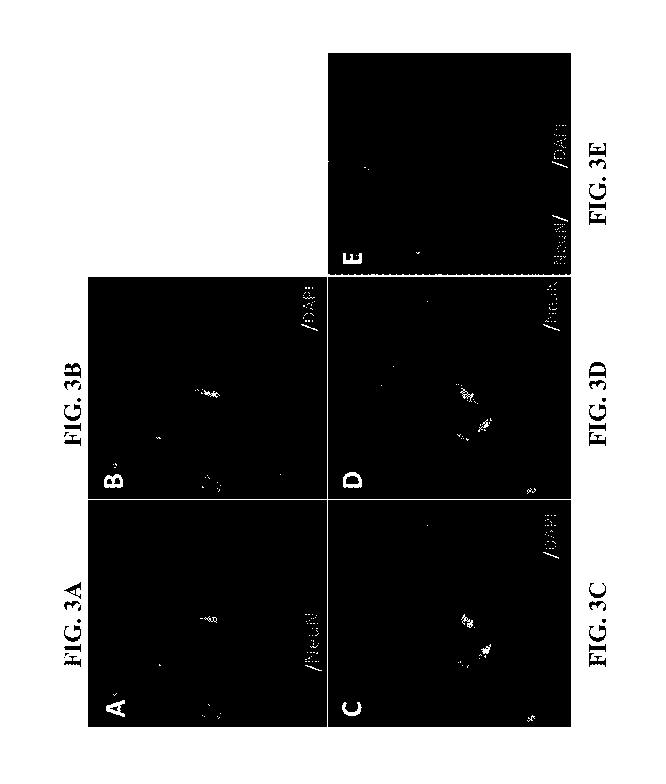 Conversion of non-neuronal cells into neurons