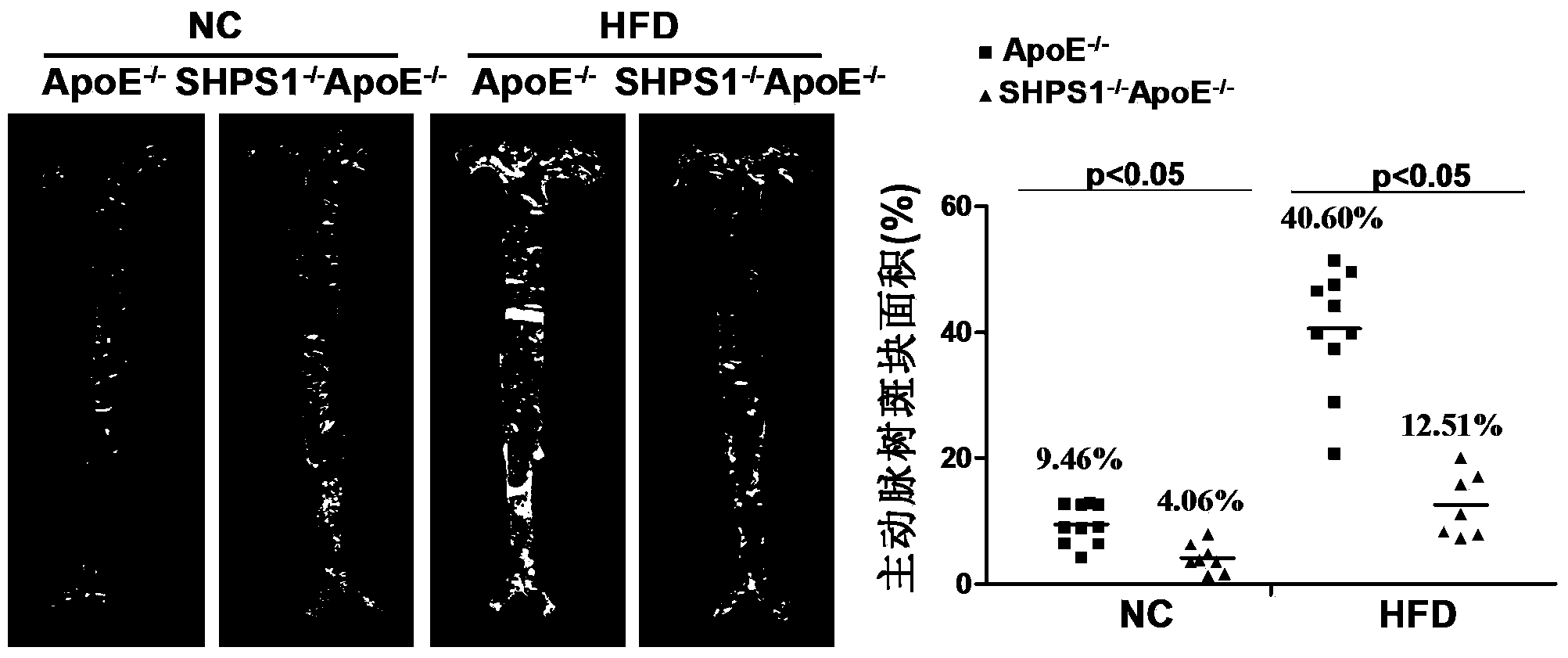 Function and application of signal regulatory protein 1 treating atherosclerosis