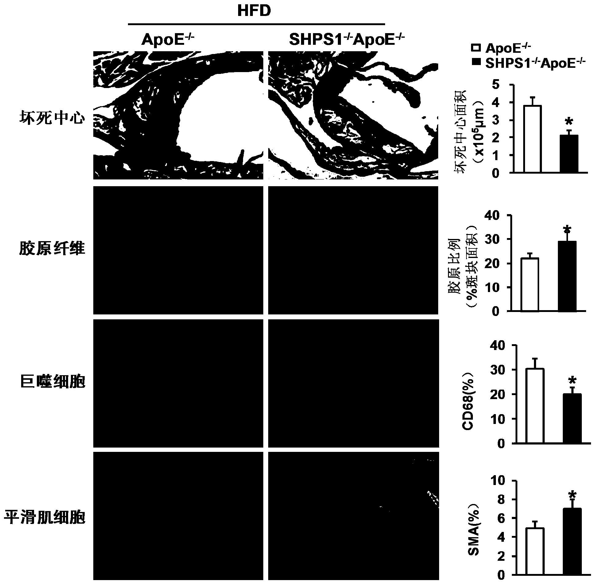 Function and application of signal regulatory protein 1 treating atherosclerosis