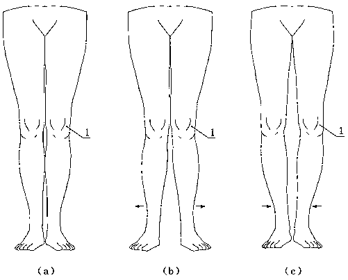 Device for correcting knee joint varus and valgus deformity