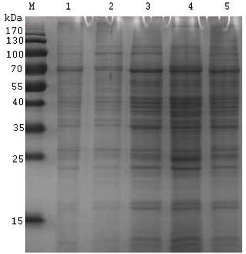 Anti-echinococcosis antigen monoclonal antibody hybridoma cell strain, anti-echinococcosis antigen monoclonal antibody and application thereof