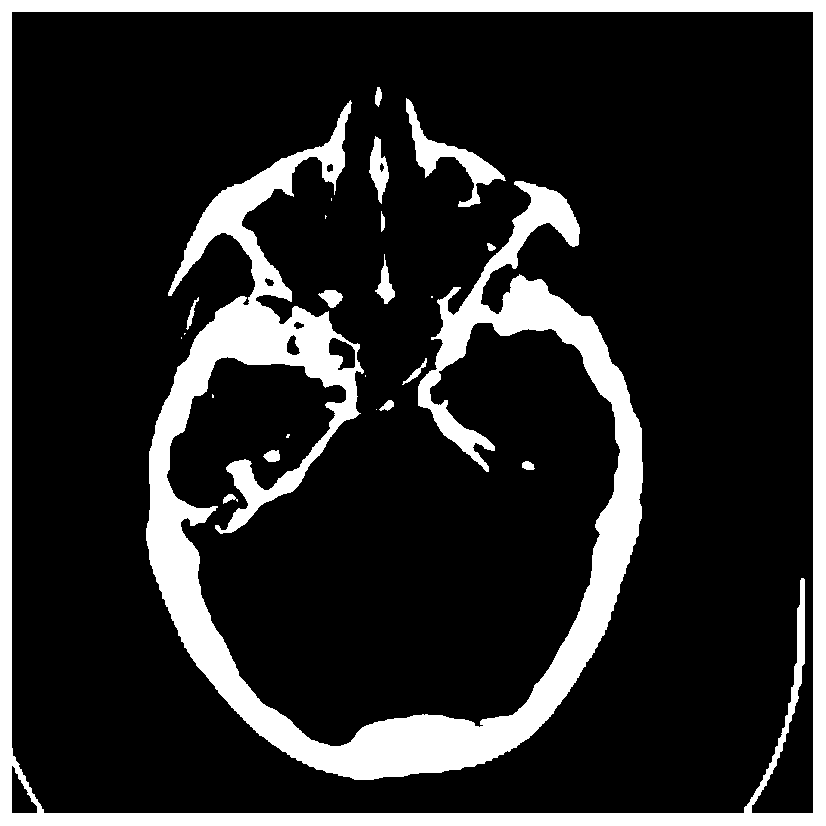 A multi-modal medical image fusion method based on guided filtering and graph theory significance