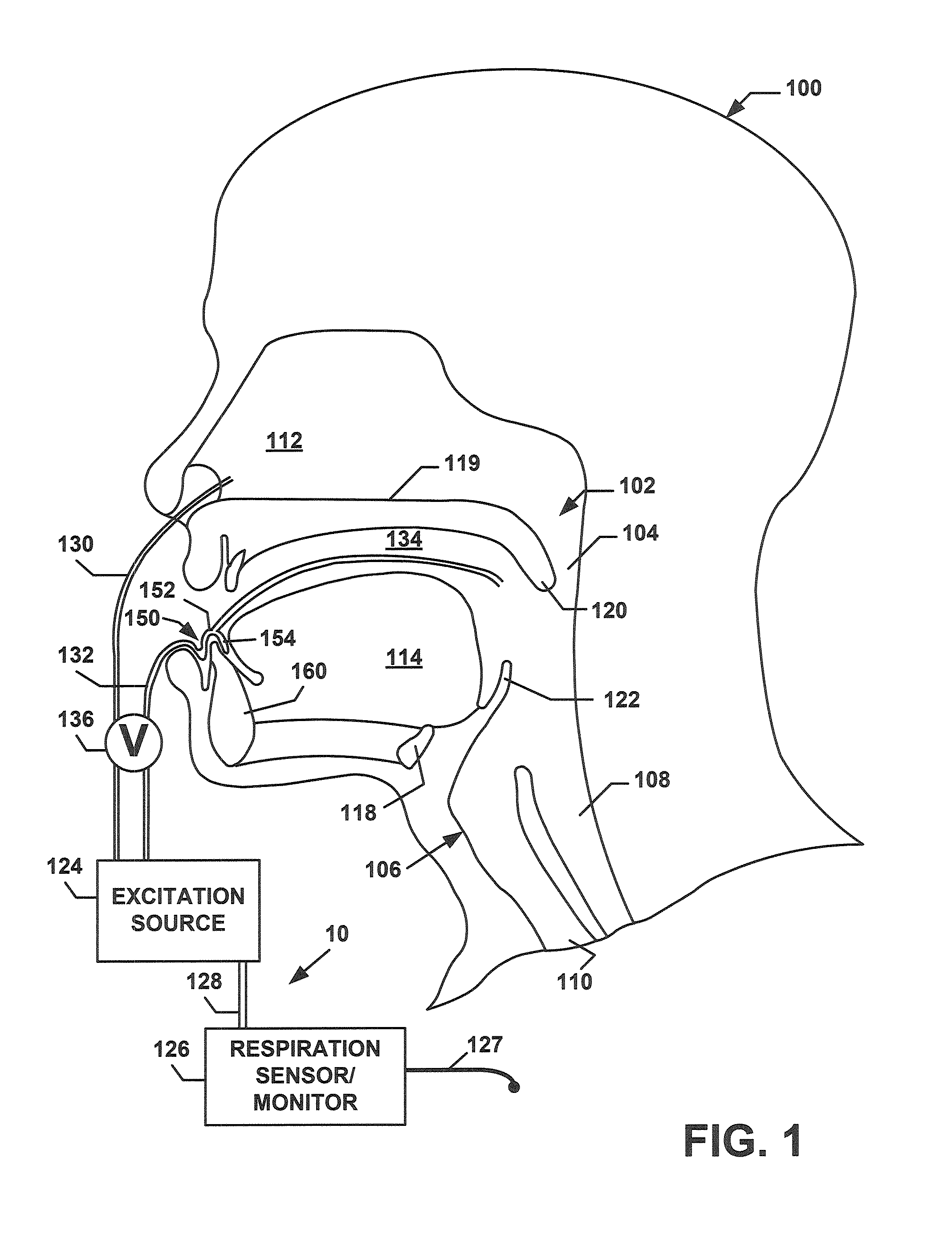 Discontinuous positive airway pressure device and method of reducing sleep disordered breathing events