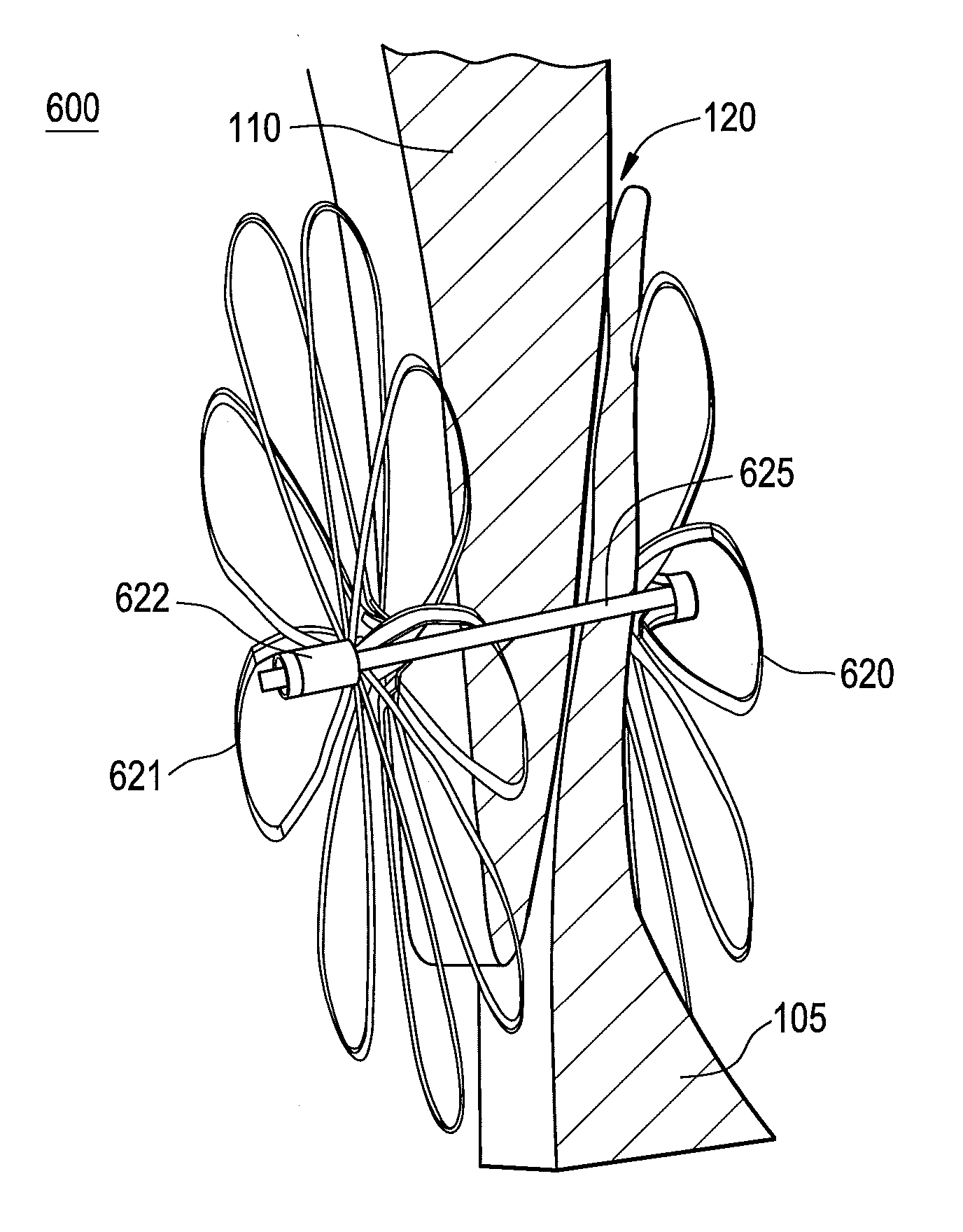 Patent foramen ovale closure method