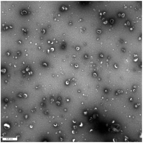 Method for separating extracellular vesicles based on metal ion complexing agent