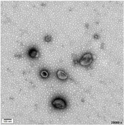 Method for separating extracellular vesicles based on metal ion complexing agent