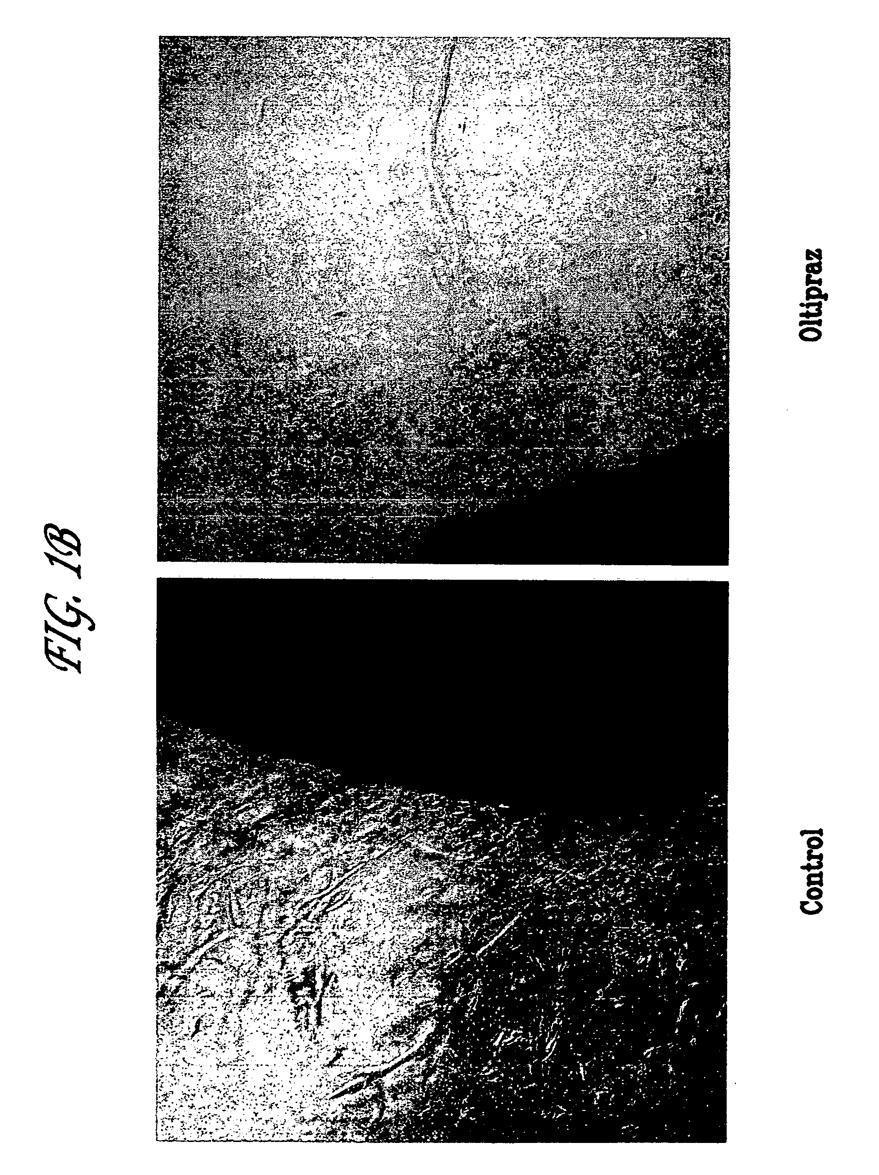 Methods for inhibiting angiogenesis