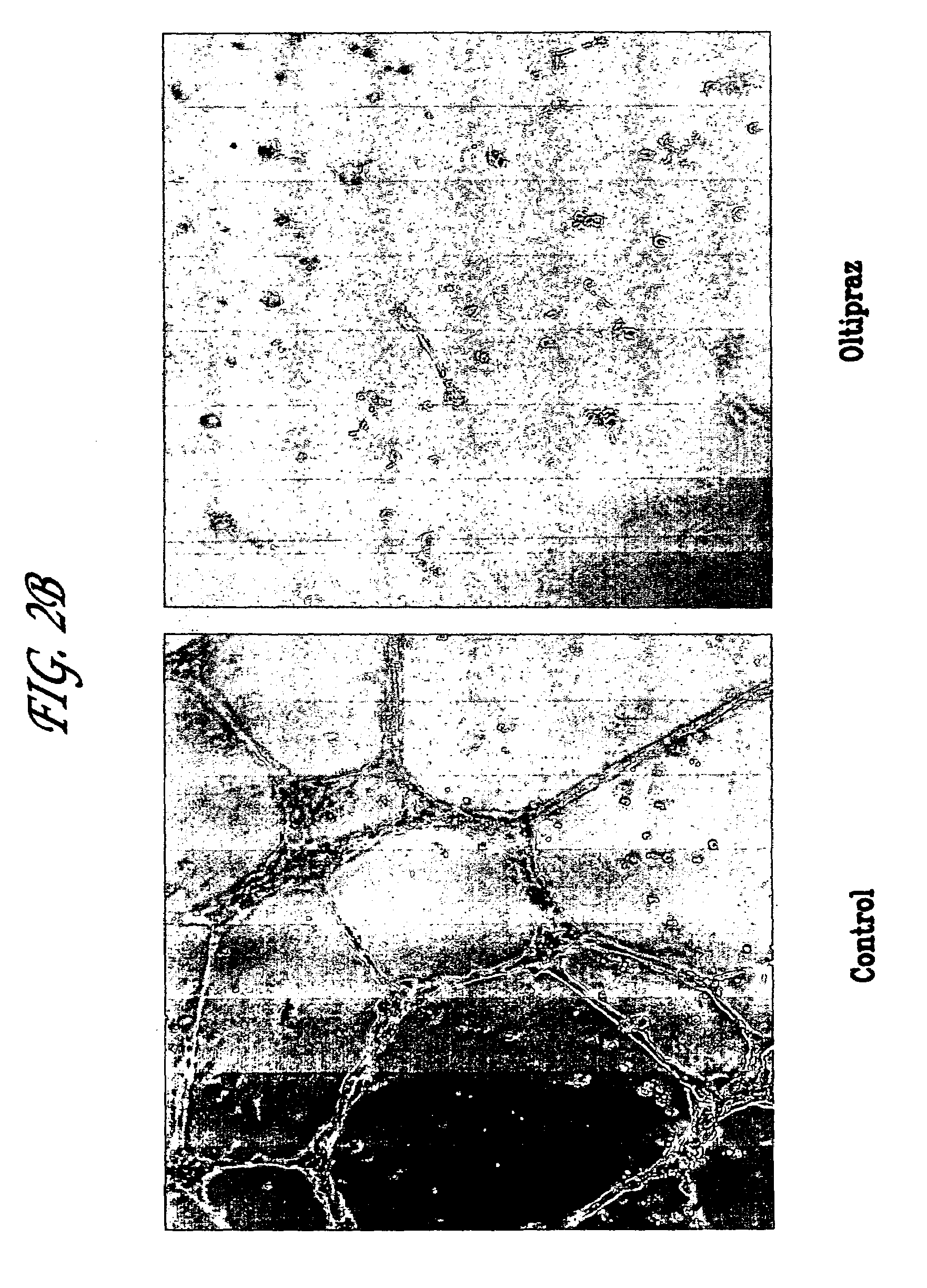 Methods for inhibiting angiogenesis