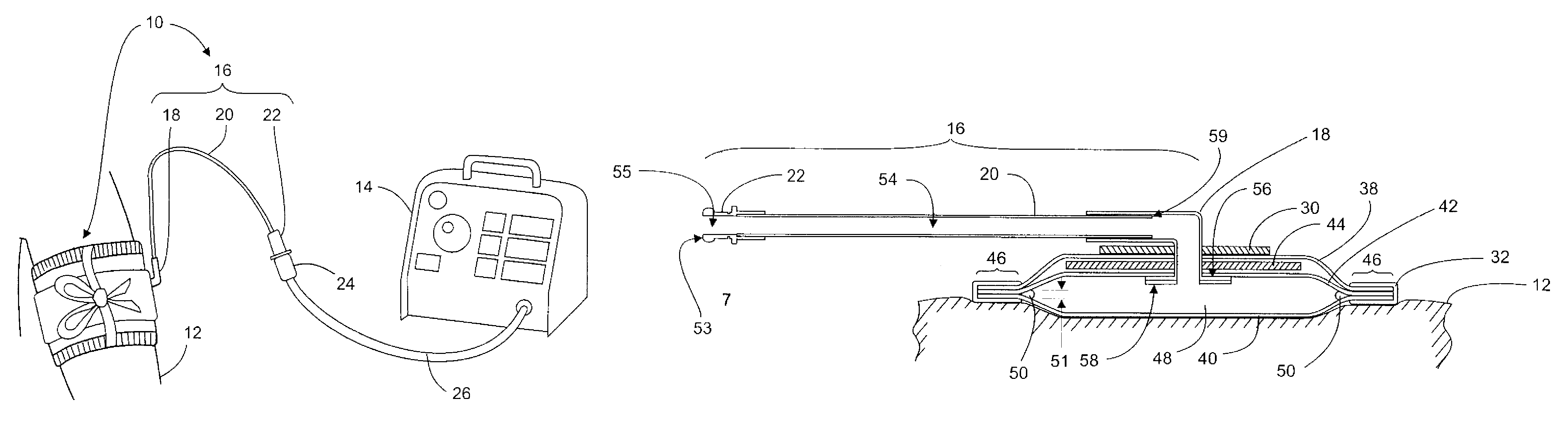 Manufacture and use of tourniquet cuff with improved pneumatic passageway