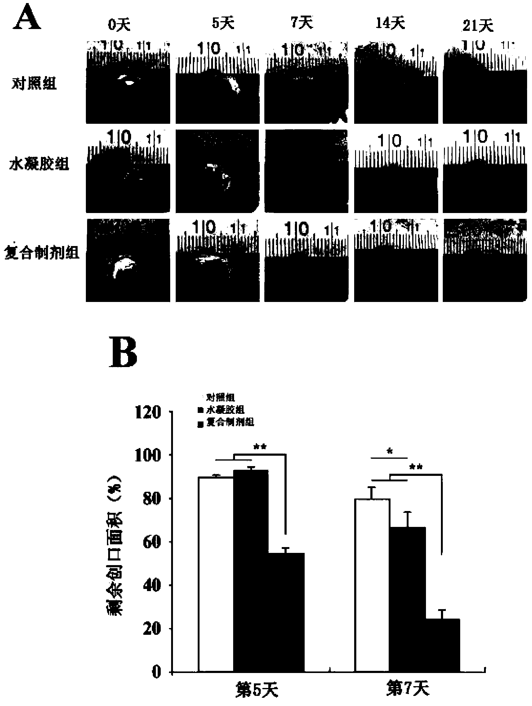 Composite preparation capable of promoting restoration of skin wound due to diabetes and preparation method thereof