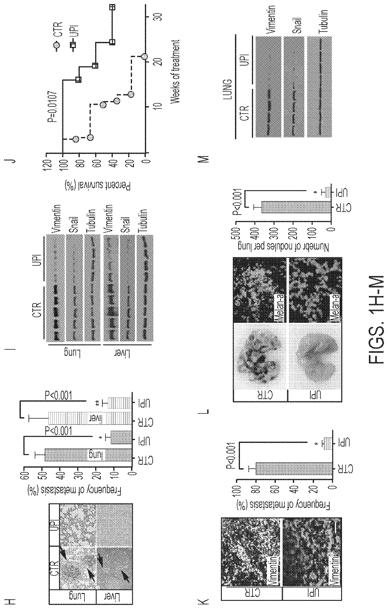 Ubiquitin interacting motif peptides as therapeutics