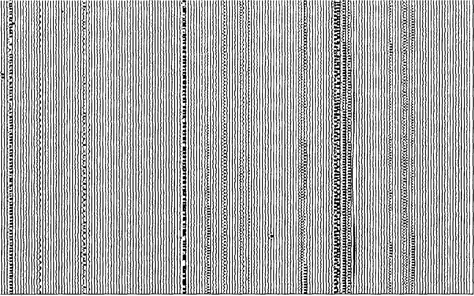 Method for removing abnormal noise in single-point reception of seismic record by digital detector