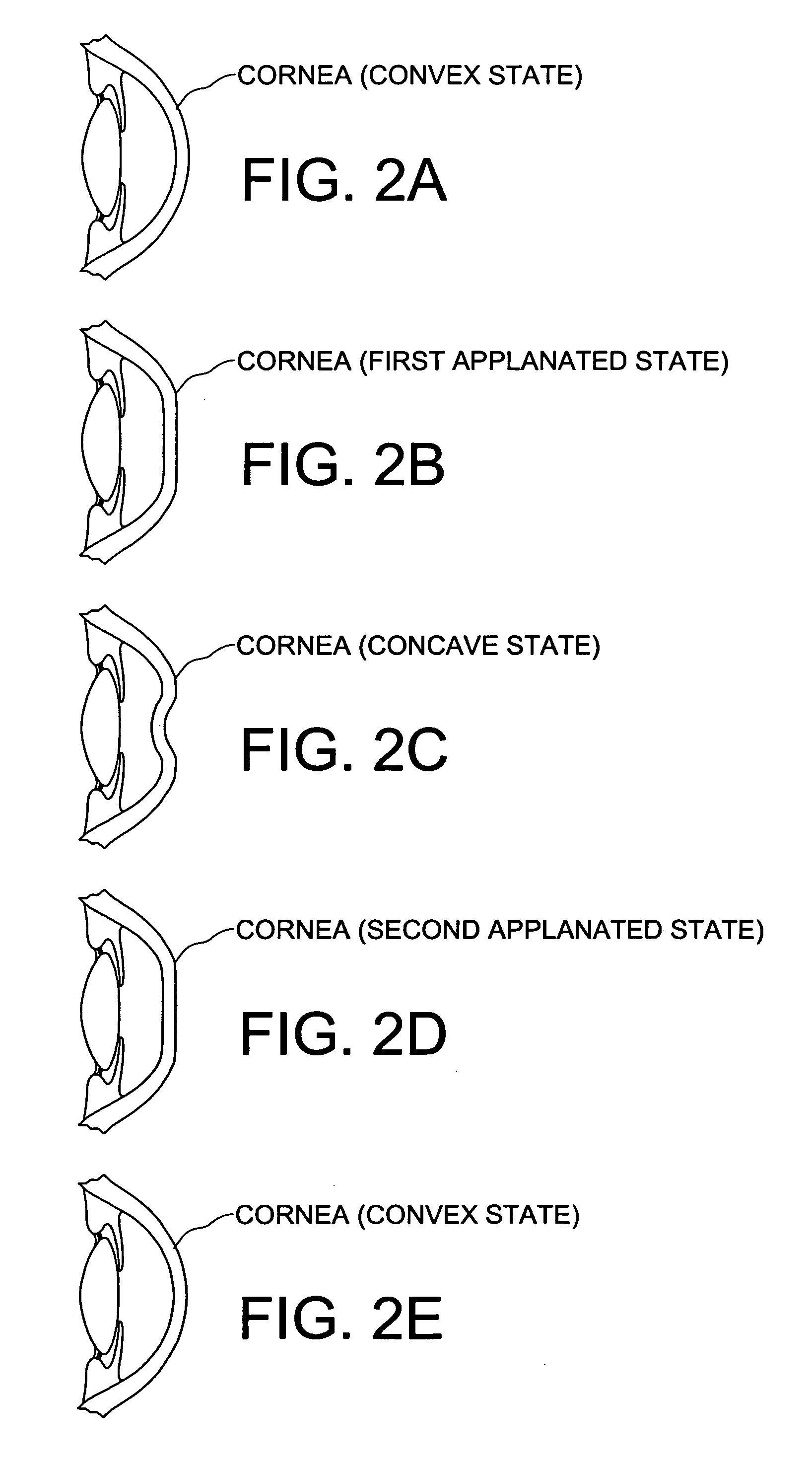 Method and apparatus for measuring corneal resistance