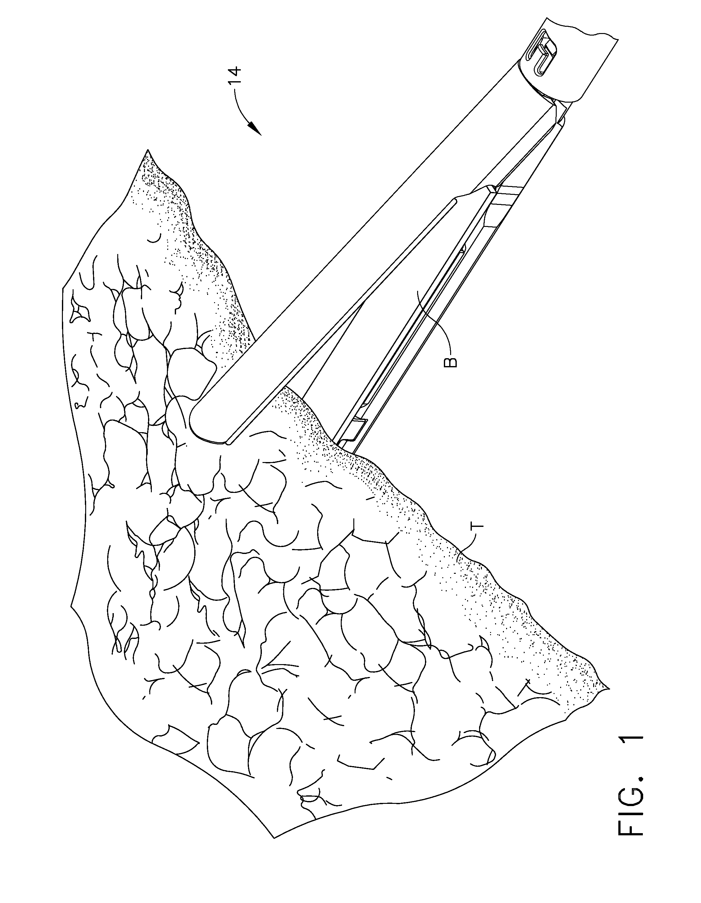 Buttress material for a surgical instrument