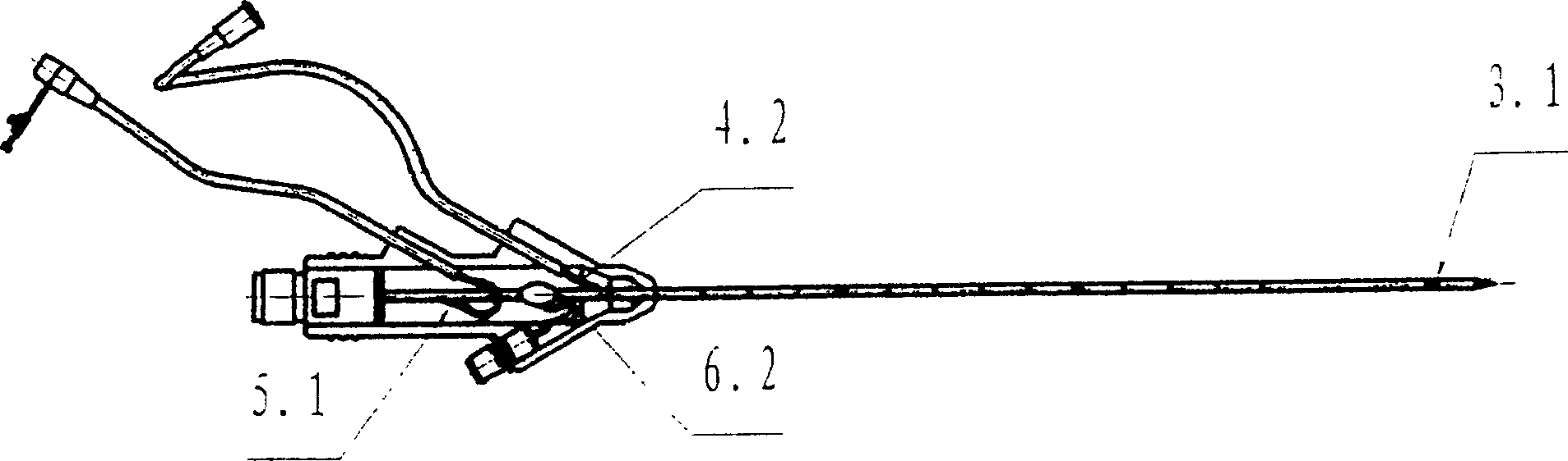 Microwave radiating antenna of direct puncture for treating tumour