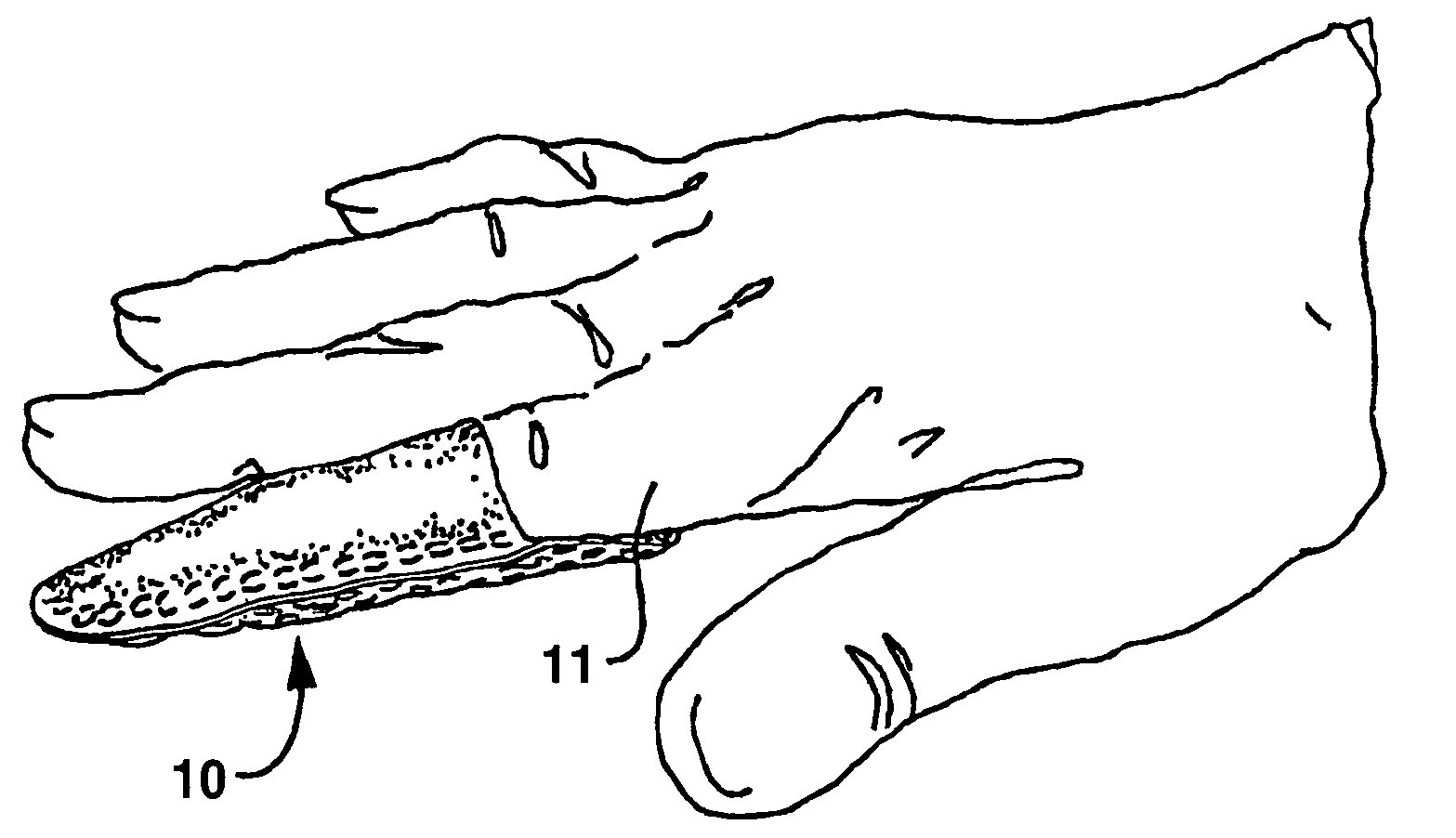 Finger wipe containing a composition in a rupturable reservoir