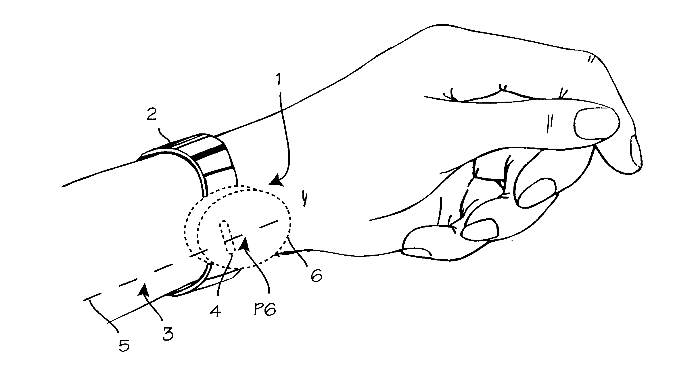 Automatically modulating acupressure device